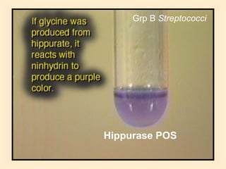 Grp B Streptococci

Hippurase POS
57

 