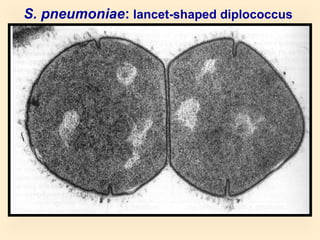 S. pneumoniae: lancet-shaped diplococcus

61

 