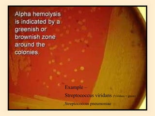Example –
Streptococcus viridans (Viridans = green)
Streptococcus pneumoniae

66

 