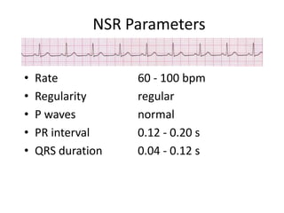 NSR ParametersRate			60 - 100 bpm	Regularity		regularP waves			normalPR interval		0.12 - 0.20 sQRS duration		0.04 - 0.12 s