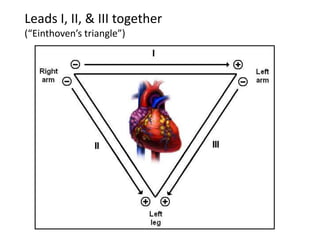 Leads I, II, & III together(“Einthoven’s triangle”)