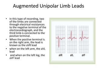 Augmented Unipolar Limb LeadsIn this type of recording, two of the limbs are connected through electrical resistances to the negative terminal of the electrocardiograph, and the third limb is connected to the positive terminal. When the positive terminal is on the right arm, the lead is known as the aVR leadwhen on the left arm, the aVL lead and when on the left leg, the aVF lead