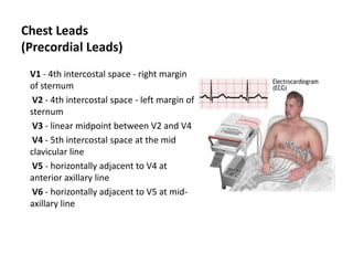 Chest Leads (Precordial Leads)V1 - 4th intercostal space - right margin of sternumV2 - 4th intercostal space - left margin of sternumV3 - linear midpoint between V2 and V4V4 - 5th intercostal space at the mid clavicular lineV5 - horizontally adjacent to V4 at anterior axillary lineV6 - horizontally adjacent to V5 at mid- axillary line