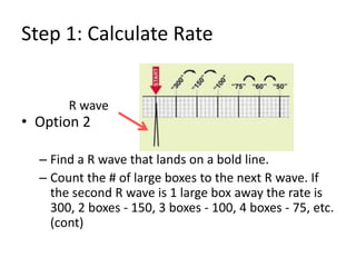 Step 1: Calculate RateOption 2 Find a R wave that lands on a bold line.Count the # of large boxes to the next R wave. If the second R wave is 1 large box away the rate is 300, 2 boxes - 150, 3 boxes - 100, 4 boxes - 75, etc.  (cont)R wave