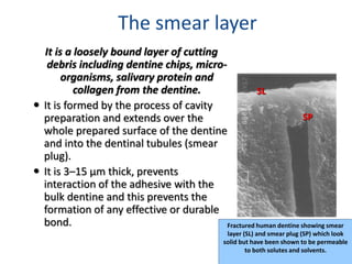 Smear Layer Modifications lec 1 Bonding to Dental Substrates or Adhesion.pptx