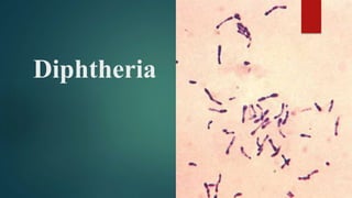 Diphtheria
 