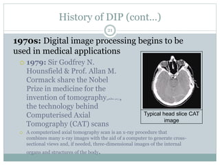 History of DIP (cont…)
1970s: Digital image processing begins to be
used in medical applications
 1979: Sir Godfrey N.
Hounsfield & Prof. Allan M.
Cormack share the Nobel
Prize in medicine for the
invention of tomography‫سطحى‬ ‫رسم‬,
the technology behind
Computerised Axial
Tomography (CAT) scans
 A computerized axial tomography scan is an x-ray procedure that
combines many x-ray images with the aid of a computer to generate cross-
sectional views and, if needed, three-dimensional images of the internal
organs and structures of the body.
Typical head slice CAT
image
21
 