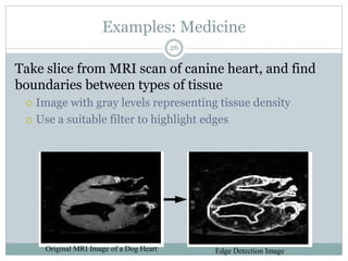 Examples: Medicine
Take slice from MRI scan of canine heart, and find
boundaries between types of tissue
 Image with gray levels representing tissue density
 Use a suitable filter to highlight edges
Original MRI Image of a Dog Heart Edge Detection Image
26
 
