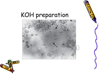 KOH preparation
 