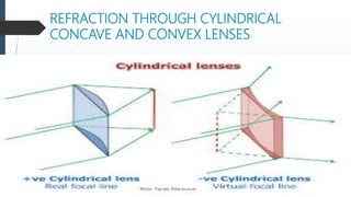 REFRACTION THROUGH CYLINDRICAL
CONCAVE AND CONVEX LENSES
 