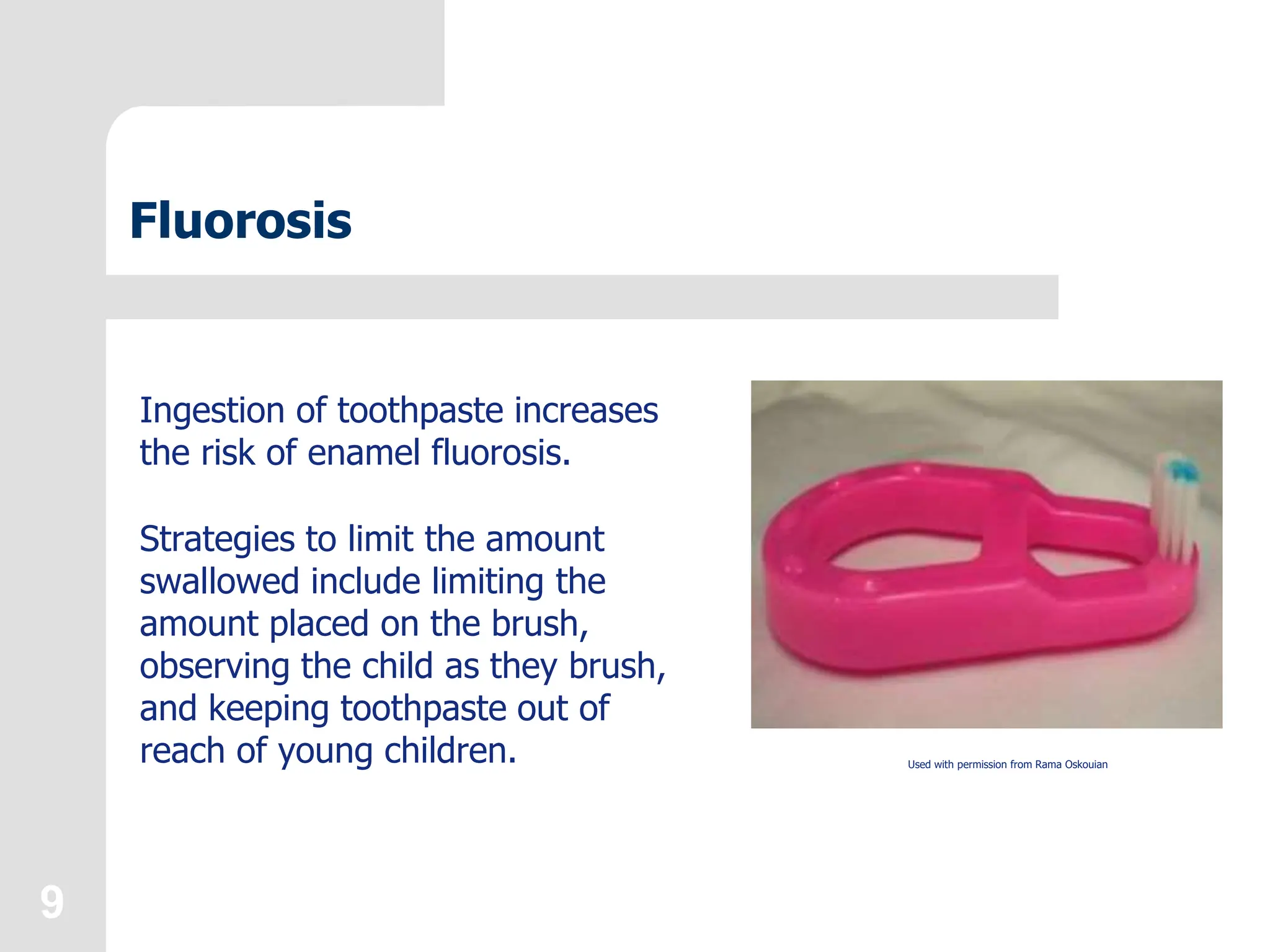 9
Fluorosis
Ingestion of toothpaste increases
the risk of enamel fluorosis.
Strategies to limit the amount
swallowed include limiting the
amount placed on the brush,
observing the child as they brush,
and keeping toothpaste out of
reach of young children. Used with permission from Rama Oskouian
 