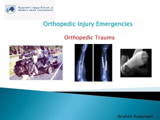 Orthopedic Injury Emergencies
Ibrahim Kadamani
Orthopedic Trauma
 