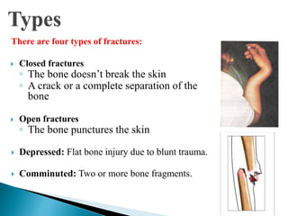 Lec 24 Orthopedic Emergency trauma fracture dislocation sprain strain.pdf