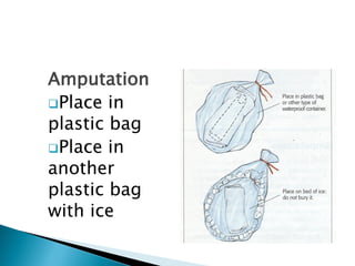 Lec 24 Orthopedic Emergency trauma fracture dislocation sprain strain.pdf