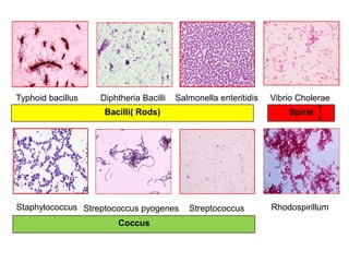 Diphtheria Bacilli
Typhoid bacillus
Rhodospirillum
Vibrio Cholerae
Staphylococcus Streptococcus pyogenes Streptococcus
Salmonella enteritidis
Bacilli( Rods) Spiral
Coccus
 