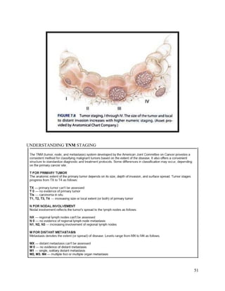 51
UNDERSTANDING TNM STAGING
 