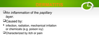 DERMATITIS
An inflammation of the papillary
layer.
Caused by:
 infection, radiation, mechanical irritation
or chemicals (e.g. poison ivy)
Characterized by itch or pain
 