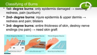 Classifying of Burns
• 1st- degree burns: only epidermis damaged → swelling,
redness, pain (sunburn)
• 2nd- degree burns: injure epidermis & upper dermis →
redness and pain; blisters
• 3rd- degree burns: entire thickness of skin, destroy nerve
endings (no pain) → need skin graft
 