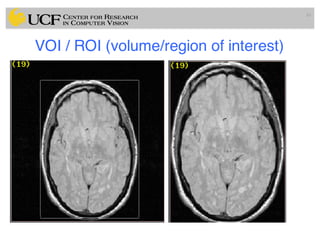 VOI / ROI (volume/region of interest)
16
 