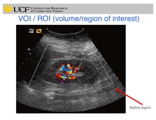 VOI / ROI (volume/region of interest)
17
Kidney region
 
