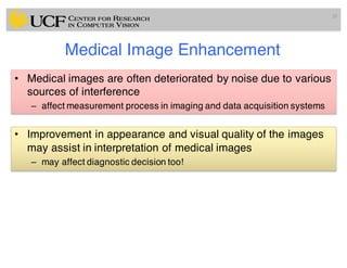Medical Image Enhancement
• Medical images are often deteriorated by noise due to various
sources of interference
– affect measurement process in imaging and data acquisition systems
• Improvement in appearance and visual quality of the images
may assist in interpretation of medical images
– may affect diagnostic decision too!
20
 