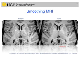 Smoothing MRI
23
Credit to:
 