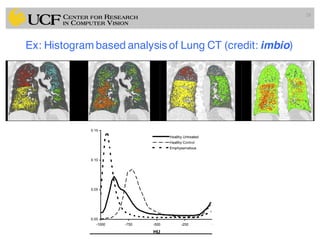 Ex: Histogram based analysis of Lung CT (credit: imbio)
28
 