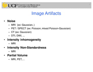 Image Artifacts
• Noise
– MRI (ex: Gaussian, )
– PET / SPECT (ex: Poisson, mixed Poisson-Gaussian)
– CT (ex: Gaussian)
– DTI, DWI, ...
• Intensity inhomogeneity
– MRI
• Intensity Non-Standardness
– MRI
• Partial Volume
– MRI, PET,…
31
 