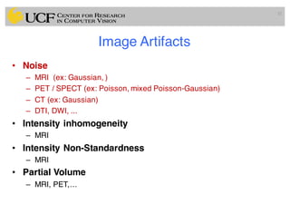 Image Artifacts
• Noise
– MRI (ex: Gaussian, )
– PET / SPECT (ex: Poisson, mixed Poisson-Gaussian)
– CT (ex: Gaussian)
– DTI, DWI, ...
• Intensity inhomogeneity
– MRI
• Intensity Non-Standardness
– MRI
• Partial Volume
– MRI, PET,…
32
 