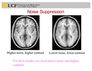 Noise Suppression
34
Higher noise, higher contrast Lower noise, lower contrast
For best results, we need lower noise and higher
contrast.
 