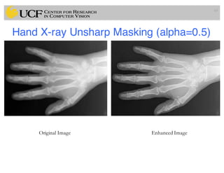 Hand X-ray Unsharp Masking (alpha=0.5)
63
Original Image Enhanced Image
 