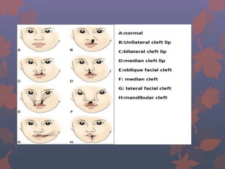 development of facial processes | PPTX