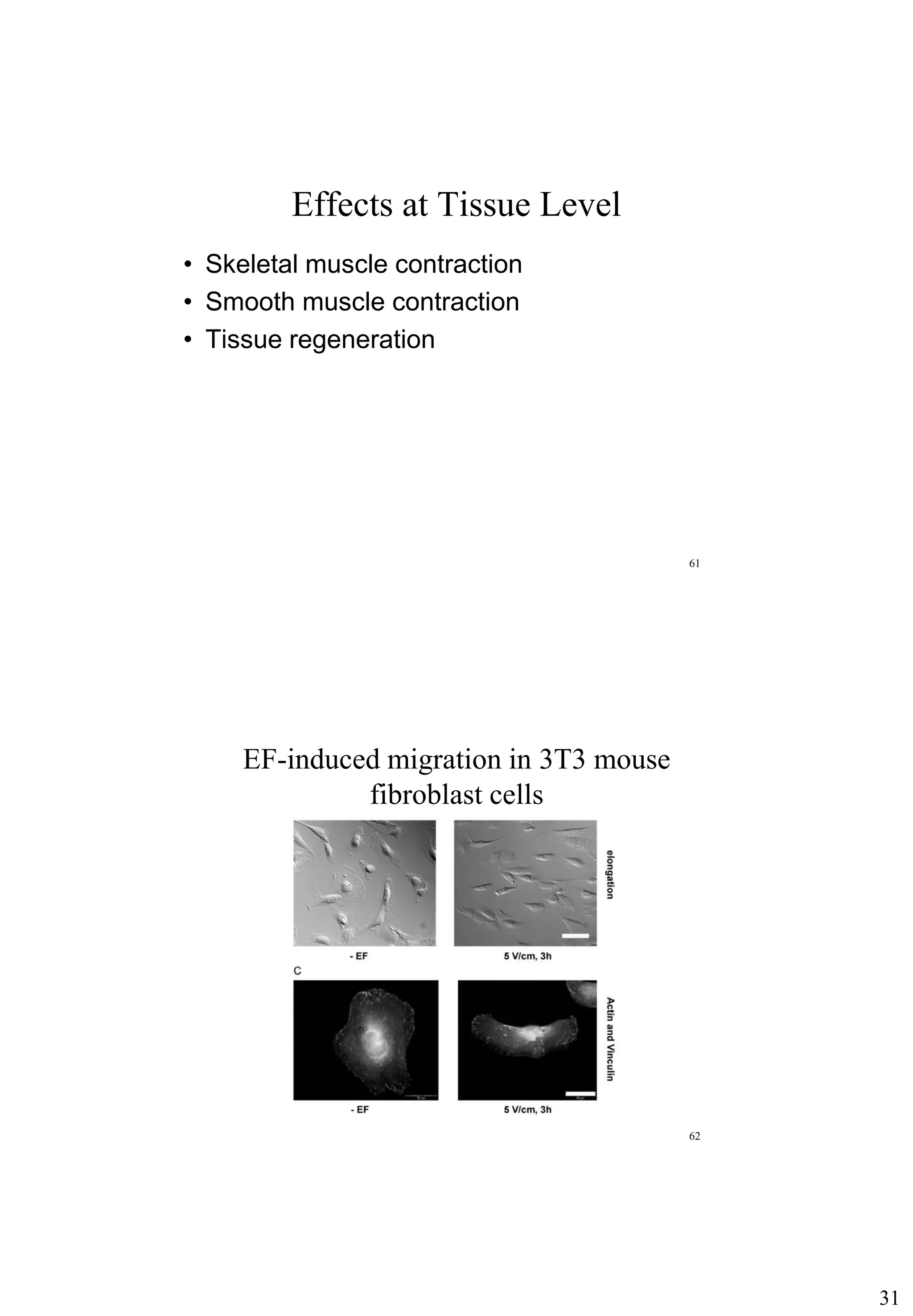 31
Effects at Tissue Level
• Skeletal muscle contraction
• Smooth muscle contraction
• Tissue regeneration
61
EF-induced migration in 3T3 mouse
fibroblast cells
62
 