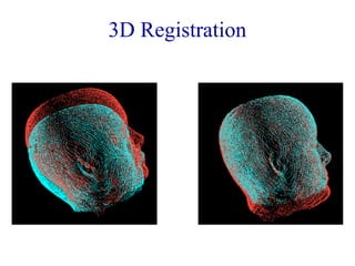 3D Registration 
 