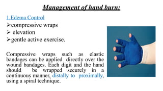 lec 3 hand & face burn.pptx.pptx