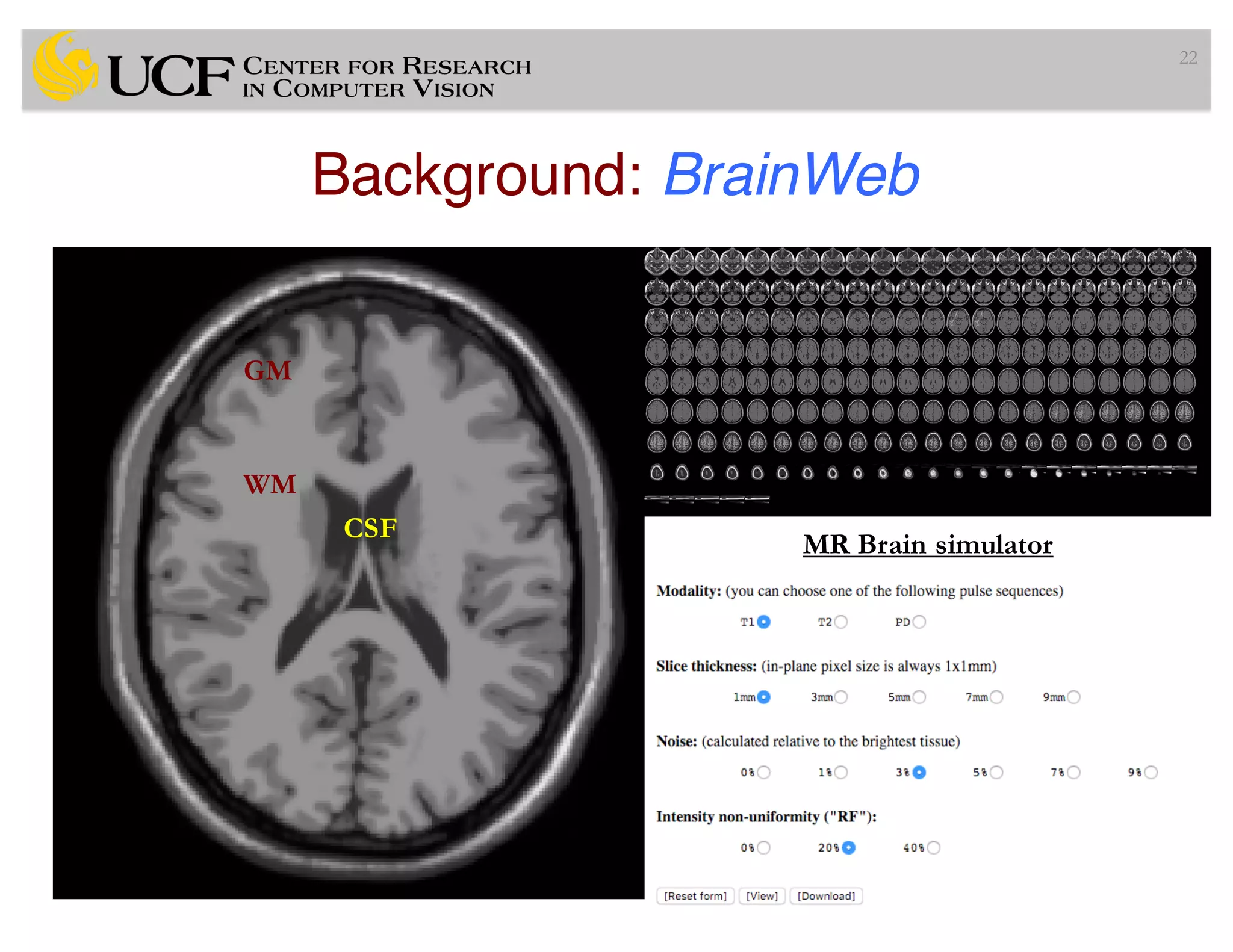 Background: BrainWeb
22
WM
GM
CSF
MR Brain simulator
 