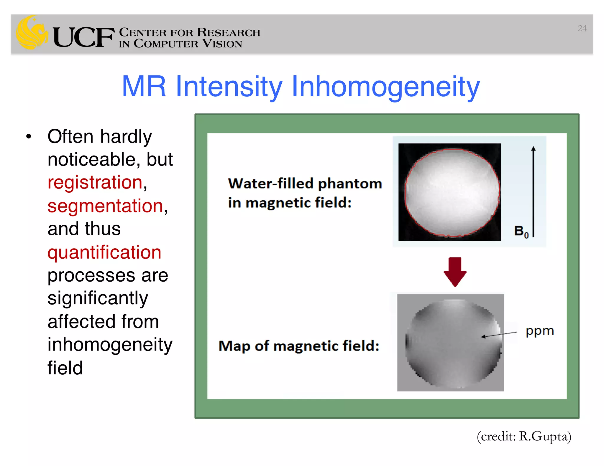 MR Intensity Inhomogeneity
• Often hardly
noticeable, but
registration,
segmentation,
and thus
quantification
processes are
significantly
affected from
inhomogeneity
field
24
(credit: R.Gupta)
 