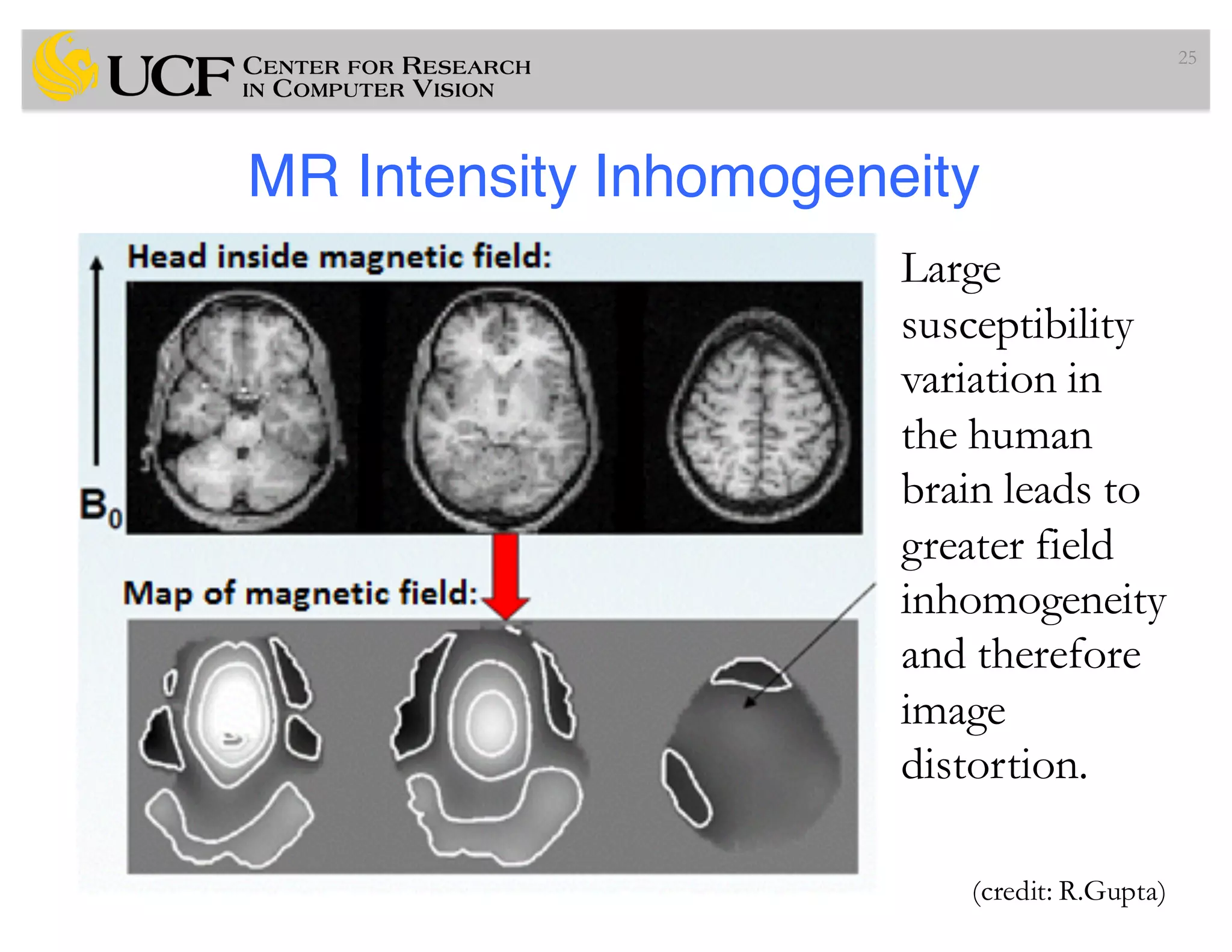 MR Intensity Inhomogeneity
25
(credit: R.Gupta)
Large
susceptibility
variation in
the human
brain leads to
greater field
inhomogeneity
and therefore
image
distortion.
 