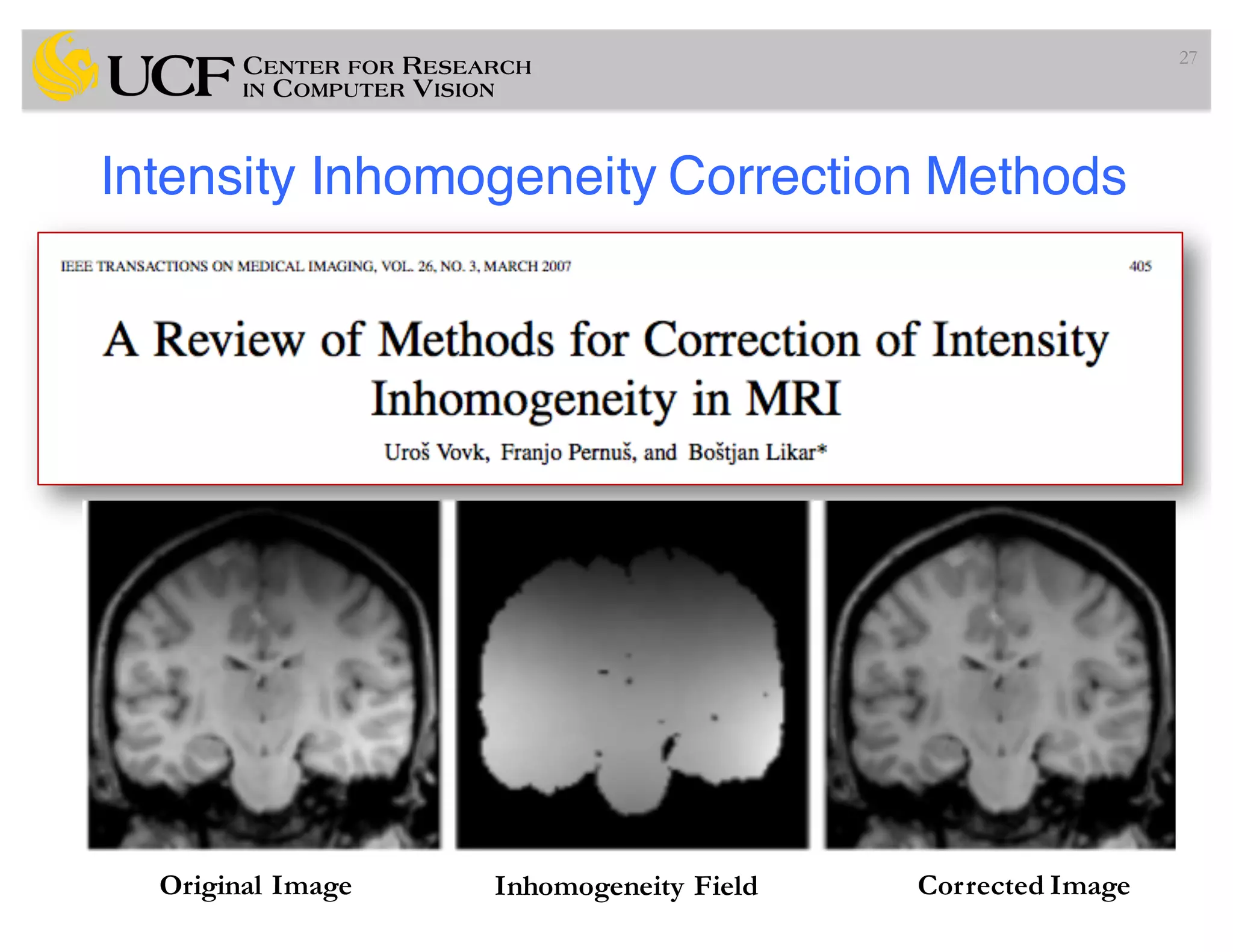 Intensity Inhomogeneity Correction Methods
27
Original Image Inhomogeneity Field Corrected Image
 