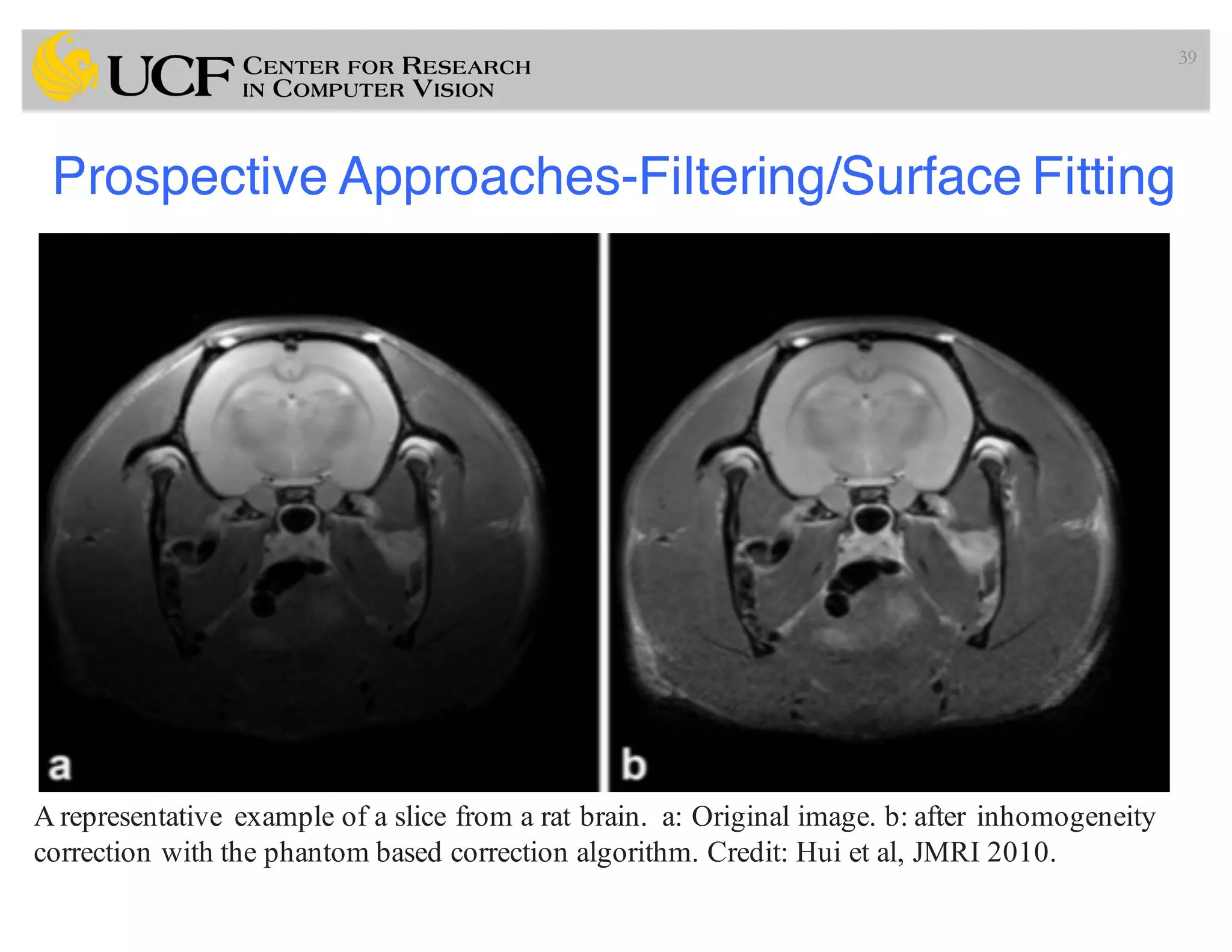 Prospective Approaches-Filtering/Surface Fitting
39
A representative example of a slice from a rat brain. a: Original image. b: after inhomogeneity
correction with the phantom based correction algorithm. Credit: Hui et al, JMRI 2010.
 