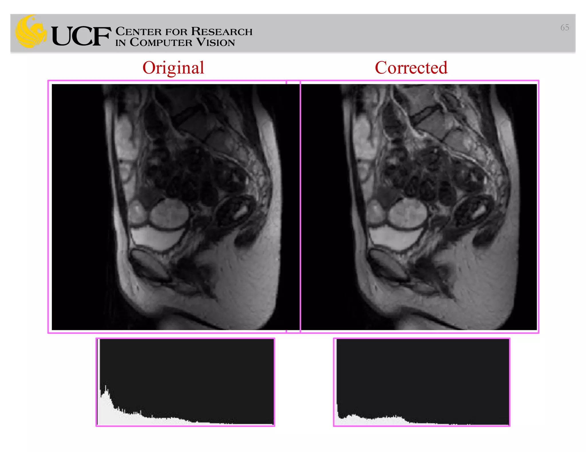 65
Original Corrected
 