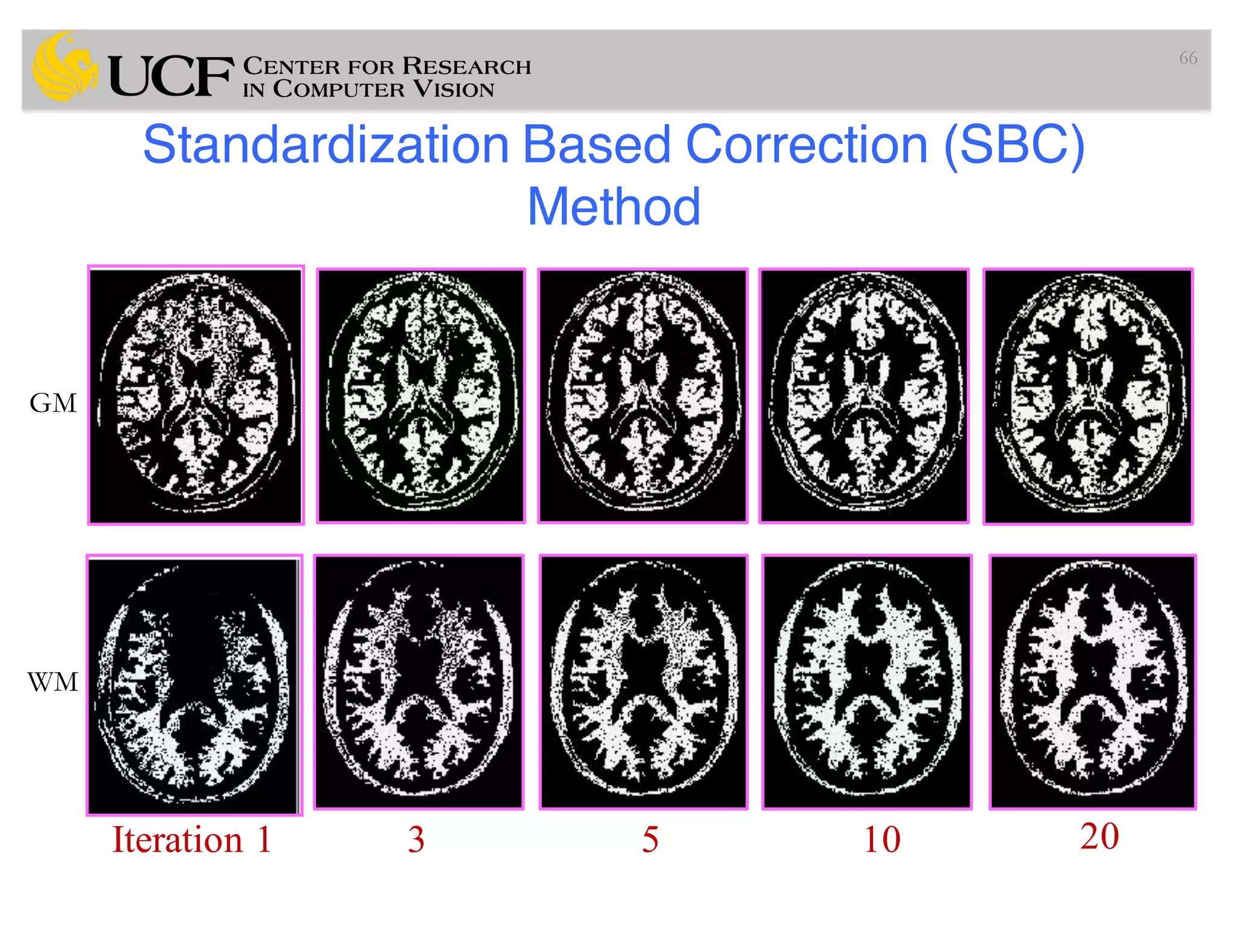 Standardization Based Correction (SBC)
Method
66
Iteration 1 3 5 10 20
GM
WM
 