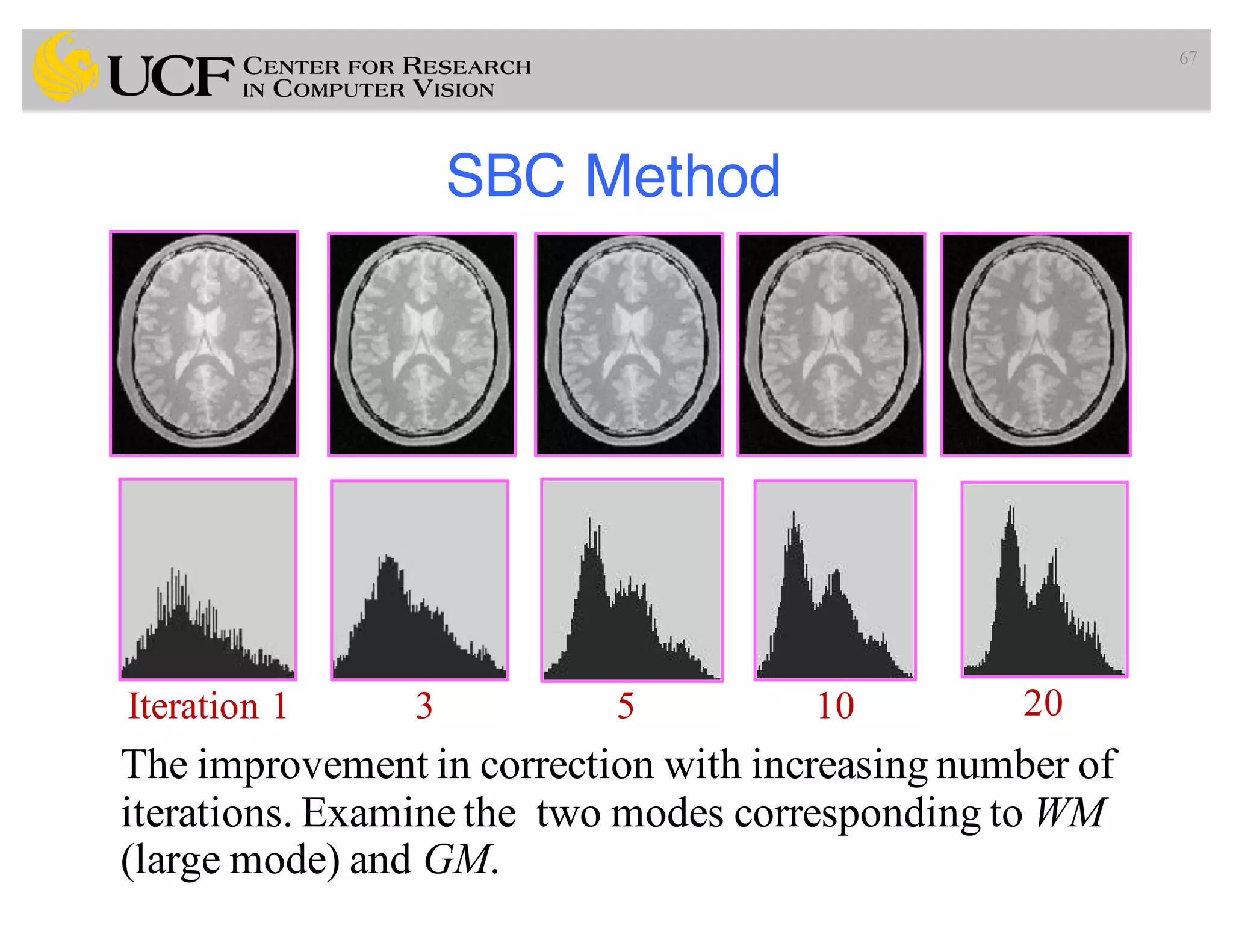 SBC Method
67
Iteration 1 3 5 10 20
The improvement in correction with increasing number of
iterations. Examine the two modes corresponding to WM
(large mode) and GM.
 