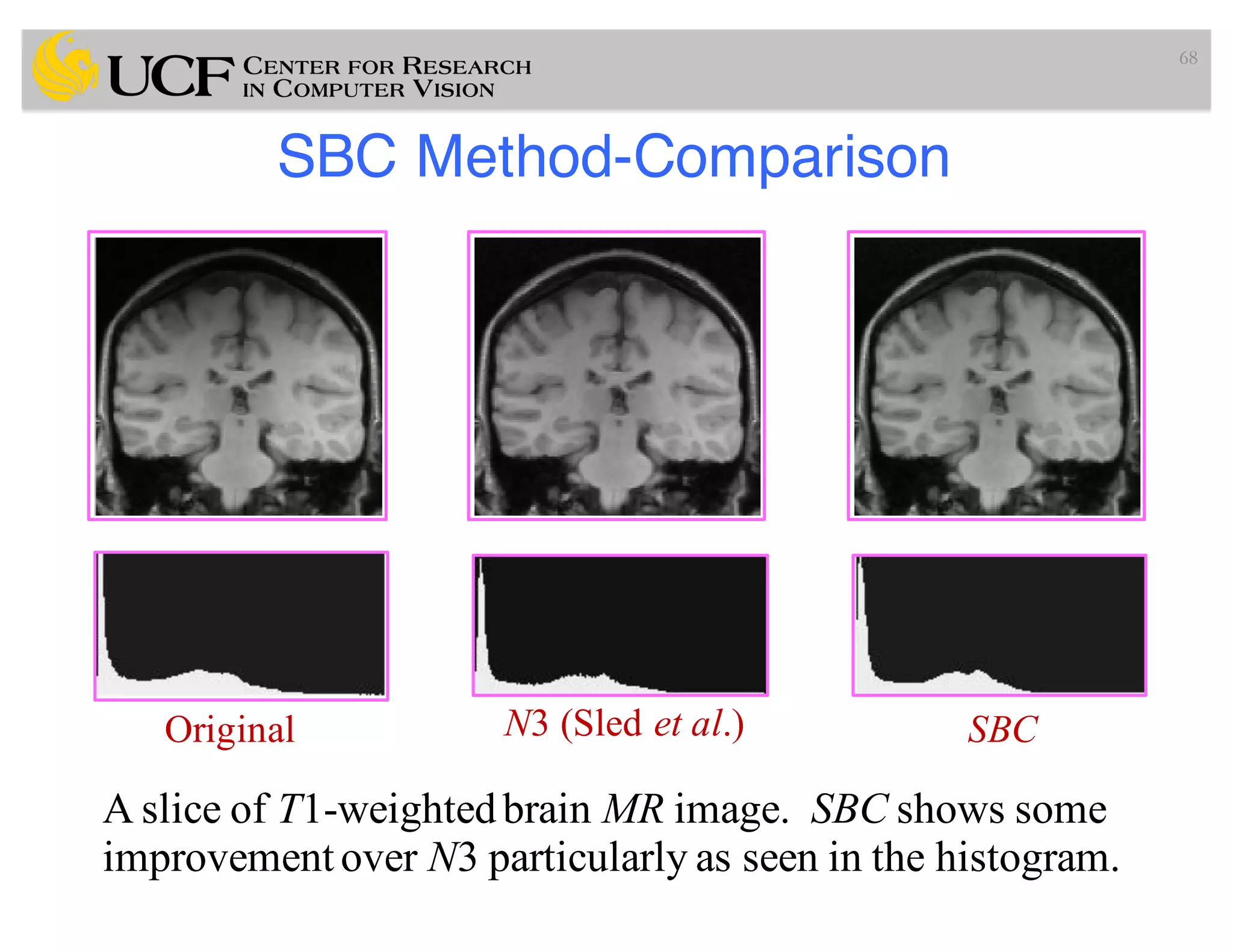 SBC Method-Comparison
68
Original N3 (Sled et al.) SBC
A slice of T1-weightedbrain MR image. SBC shows some
improvement over N3 particularly as seen in the histogram.
 
