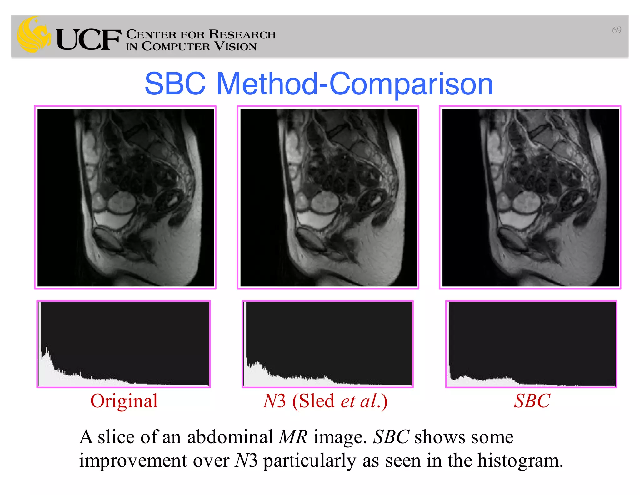 SBC Method-Comparison
69
Original N3 (Sled et al.) SBC
A slice of an abdominal MR image. SBC shows some
improvement over N3 particularly as seen in the histogram.
 