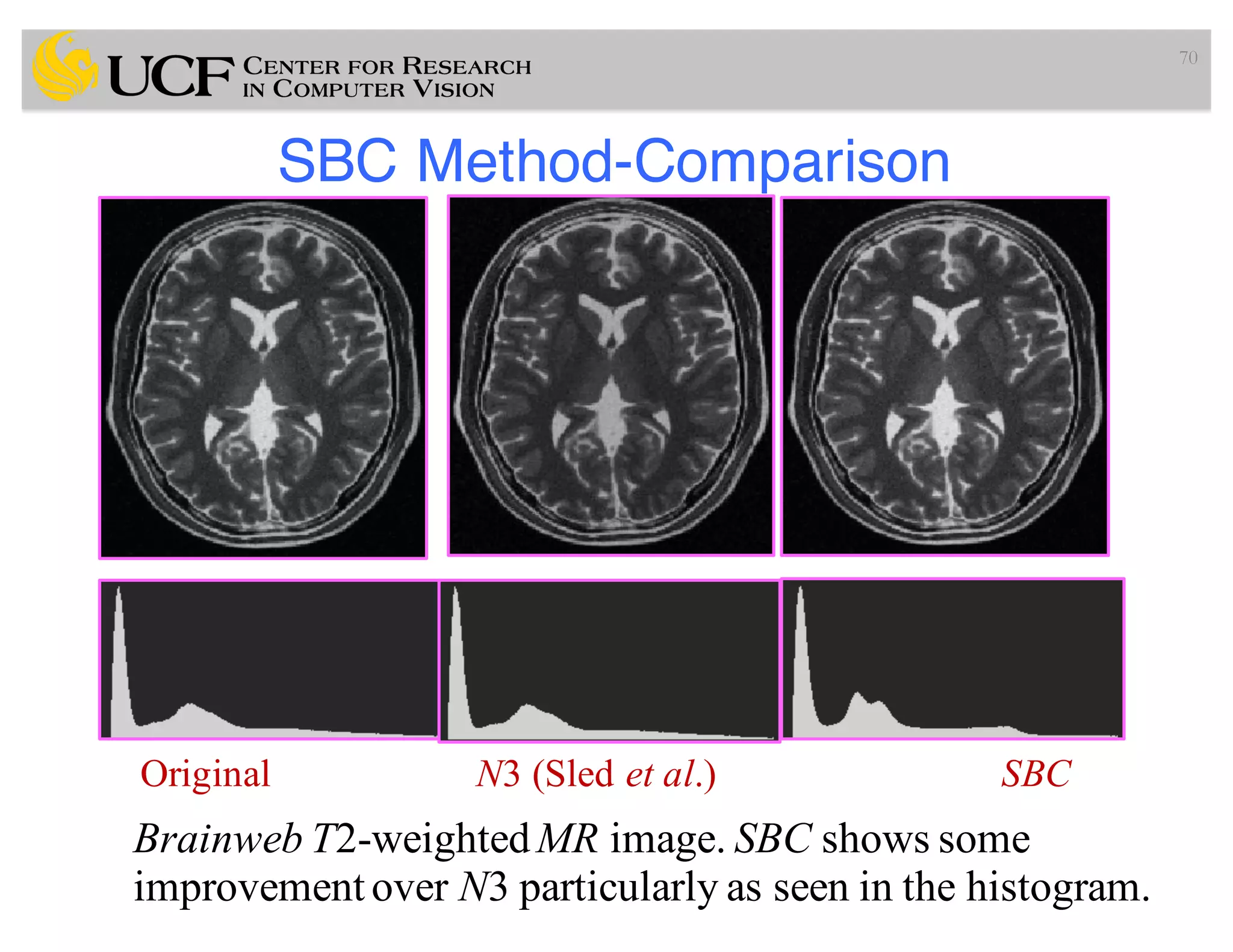 SBC Method-Comparison
70
Original N3 (Sled et al.) SBC
Brainweb T2-weightedMR image. SBC shows some
improvement over N3 particularly as seen in the histogram.
 