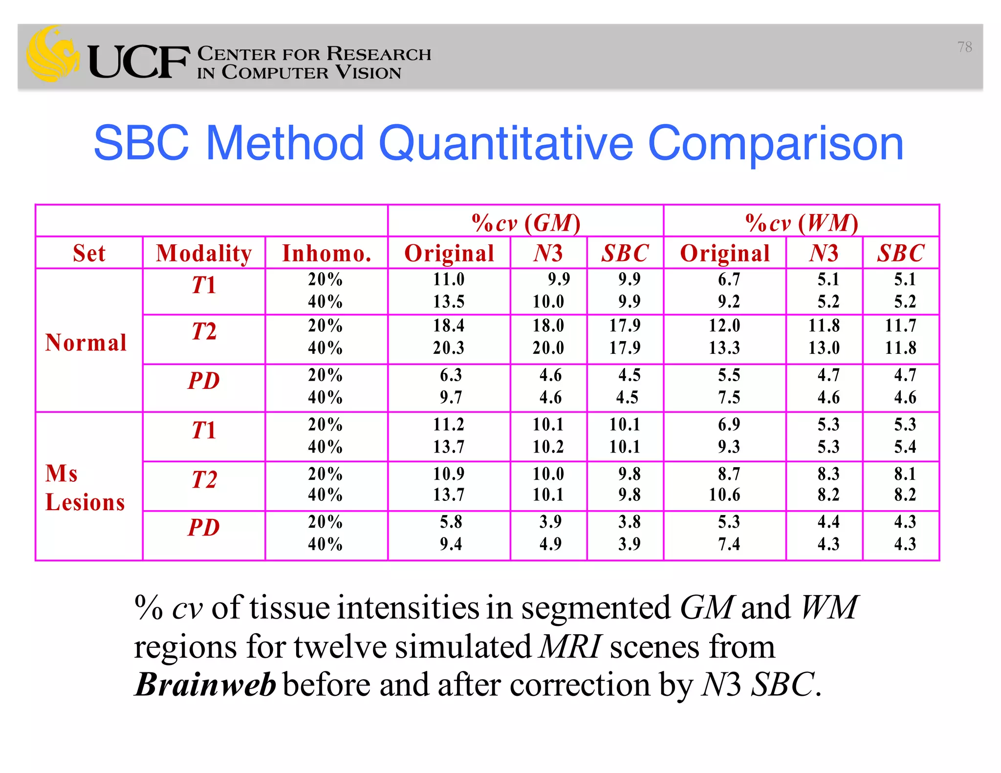 SBC Method Quantitative Comparison
78
%cv (GM) %cv (WM)
Set Modality Inhomo. Original N3 SBC Original N3 SBC
Normal
T1 20%
40%
11.0
13.5
9.9
10.0
9.9
9.9
6.7
9.2
5.1
5.2
5.1
5.2
T2 20%
40%
18.4
20.3
18.0
20.0
17.9
17.9
12.0
13.3
11.8
13.0
11.7
11.8
PD 20%
40%
6.3
9.7
4.6
4.6
4.5
4.5
5.5
7.5
4.7
4.6
4.7
4.6
Ms
Lesions
T1 20%
40%
11.2
13.7
10.1
10.2
10.1
10.1
6.9
9.3
5.3
5.3
5.3
5.4
T2 20%
40%
10.9
13.7
10.0
10.1
9.8
9.8
8.7
10.6
8.3
8.2
8.1
8.2
PD 20%
40%
5.8
9.4
3.9
4.9
3.8
3.9
5.3
7.4
4.4
4.3
4.3
4.3
% cv of tissue intensitiesin segmented GM and WM
regions for twelve simulated MRI scenes from
Brainwebbefore and after correction by N3 SBC.
 