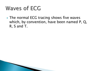  The normal ECG tracing shows five waves
which, by convention, have been named P, Q,
R, S and T.
 
