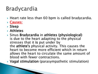  Heart rate less than 60 bpm is called bradycardia.
 Causes:
 Sleep
 Athletes
 Sinus Bradycardia in athletes (physiological)
is due to the heart adapting to the physical
stresses that it is put under by
the athlete's physical activity. This causes the
heart to become more efficient which in return
allows the heart to circulate the same amount of
blood with fewer contractions.
 Vagal stimulation (parasympathetic stimulation)
 