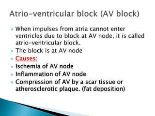  When impulses from atria cannot enter
ventricles due to block at AV node, it is called
atrio-ventricular block.
 The block is at AV node
 Causes:
 Ischemia of AV node
 Inflammation of AV node
 Compression of AV by a scar tissue or
atherosclerotic plaque. (fat deposition)
 